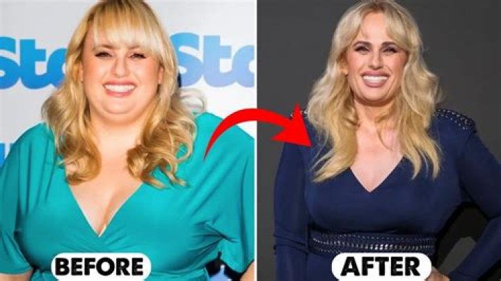 Astonishing Transformation: Heidi Pratt's Journey Before And After