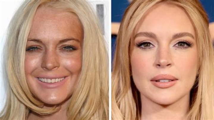Heidi Montag's Incredible Plastic Surgery Transformation: Before And After