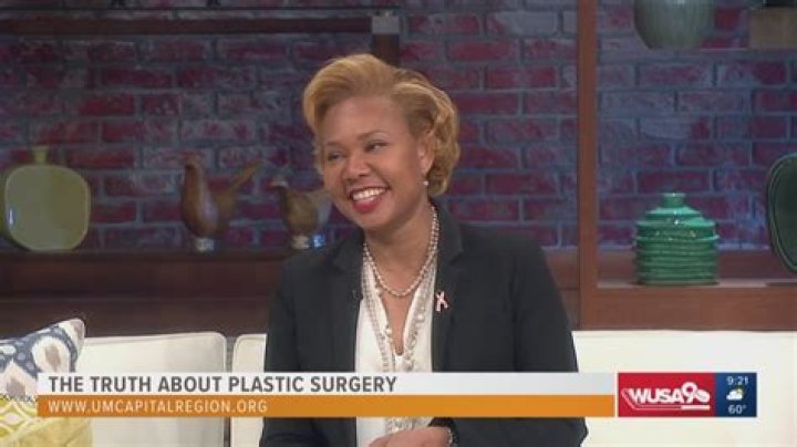 Joyce Meyer's Candid Journey: Uncovering The Truth About Plastic Surgery