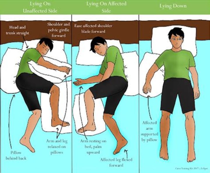 Mastering Left-Sided Hemiparesis: A Comprehensive Guide