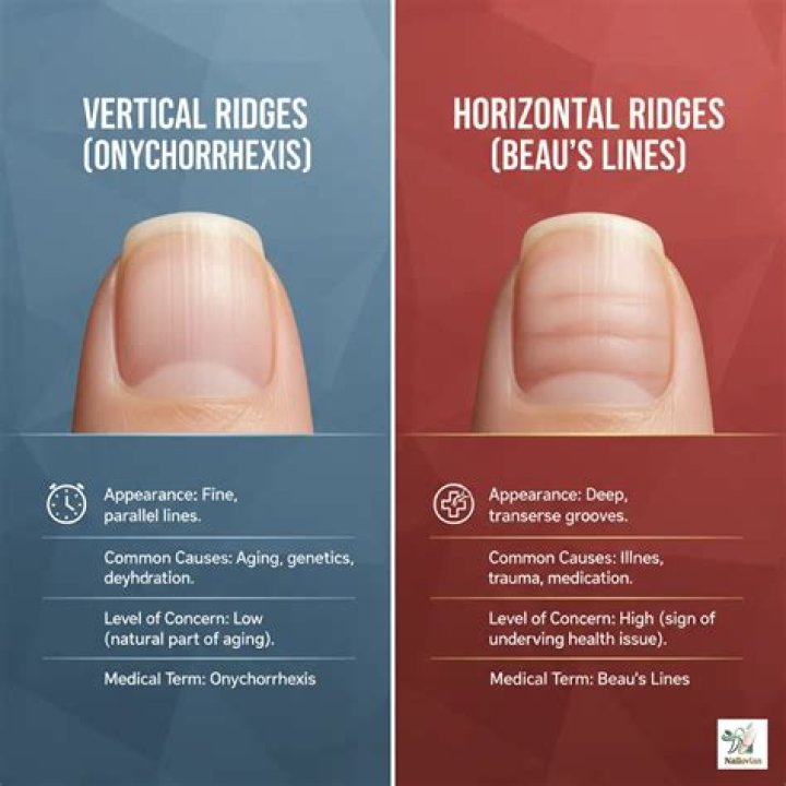 Uncover The Causes Behind Horizontal Nail Ridges: A Comprehensive Guide